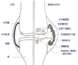 右膝